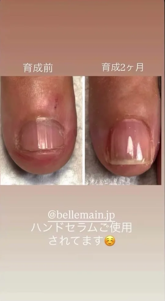 ベリュマン使用例 CASE 02（使用前・使用後）