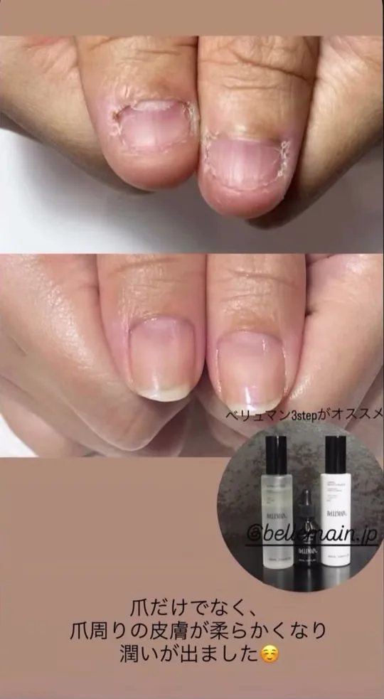 ベリュマン使用例 CASE 09（使用前・使用後）