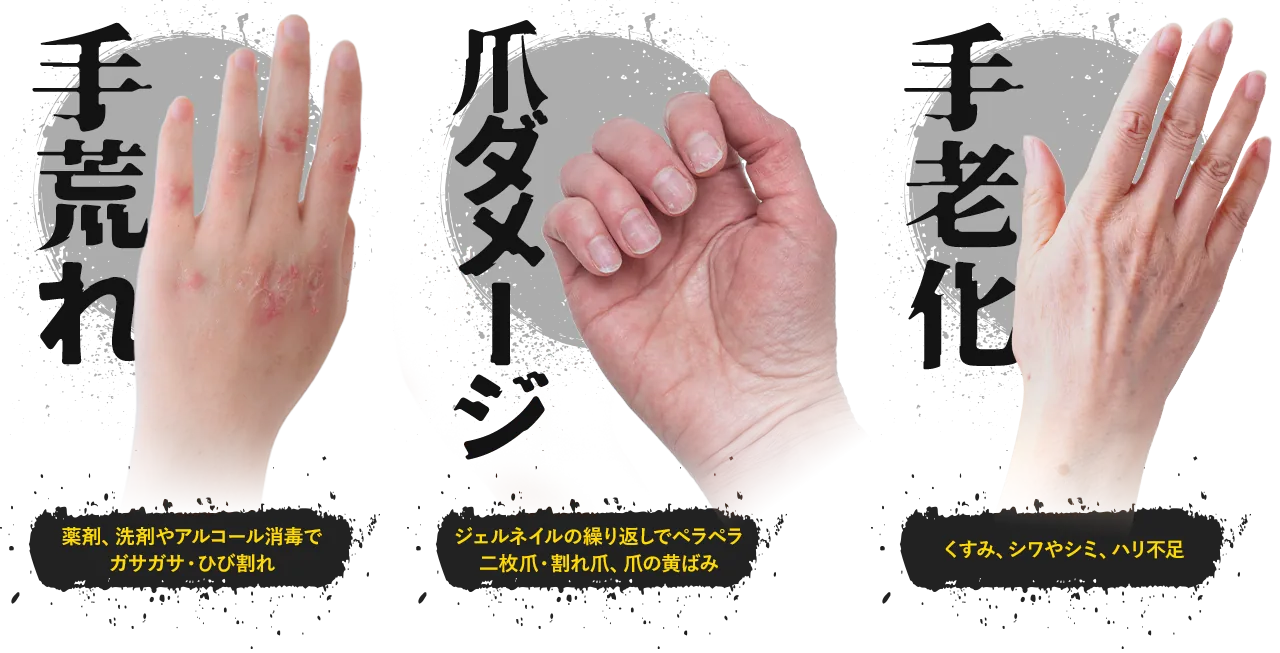 手荒れ・爪ダメージ・手老化