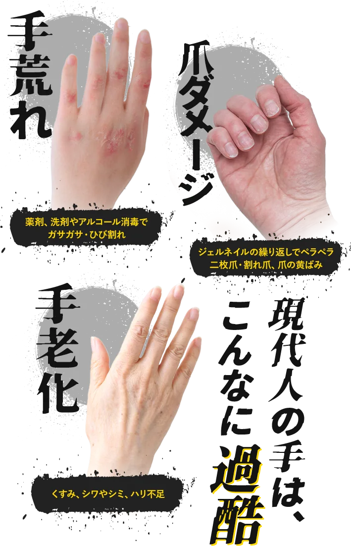 手荒れ・爪ダメージ・手老化 現代人の手は、こんなに過酷